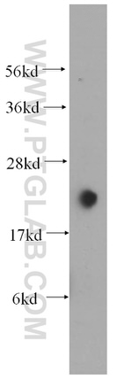 HSPB8 Antibody in Western Blot (WB)