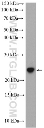 HSPB8 Antibody in Western Blot (WB)