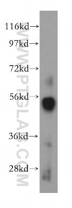 SC65 Antibody in Western Blot (WB)