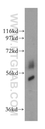 SC65 Antibody in Western Blot (WB)