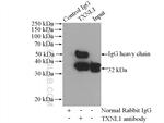 TXNL1 Antibody in Immunoprecipitation (IP)