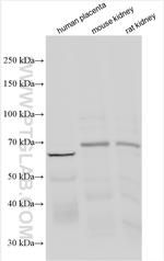 MCOLN1 Antibody in Western Blot (WB)