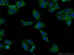 ARFGAP3 Antibody in Immunocytochemistry (ICC/IF)