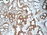ARFGAP3 Antibody in Immunohistochemistry (Paraffin) (IHC (P))
