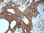 ARFGAP3 Antibody in Immunohistochemistry (Paraffin) (IHC (P))