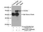 ARFGAP3 Antibody in Immunoprecipitation (IP)