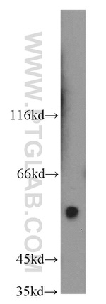 ARFGAP3 Antibody in Western Blot (WB)