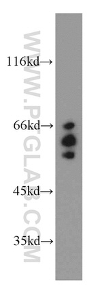 ARFGAP3 Antibody in Western Blot (WB)