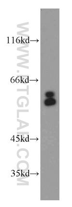ARFGAP3 Antibody in Western Blot (WB)