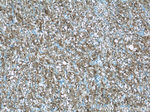 ADRP/Perilipin 2 Antibody in Immunohistochemistry (Paraffin) (IHC (P))