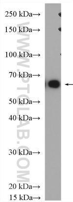 MAGEA10 Antibody in Western Blot (WB)