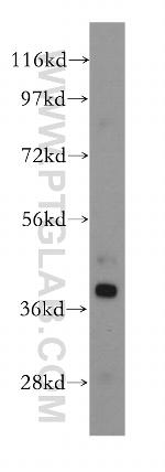 RPH3AL Antibody in Western Blot (WB)