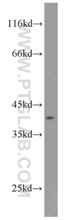 RPH3AL Antibody in Western Blot (WB)