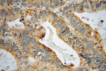 GRB14 Antibody in Immunohistochemistry (Paraffin) (IHC (P))