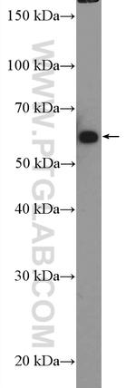 GRB14 Antibody in Western Blot (WB)