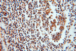 NDUFV2 Antibody in Immunohistochemistry (Paraffin) (IHC (P))