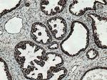 NDUFV2 Antibody in Immunohistochemistry (Paraffin) (IHC (P))