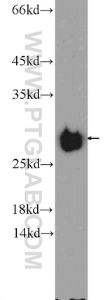 NDUFV2 Antibody in Western Blot (WB)
