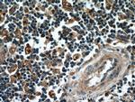 GBP1 Antibody in Immunohistochemistry (Paraffin) (IHC (P))