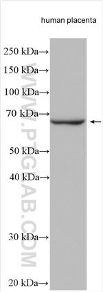 GBP1 Antibody in Western Blot (WB)