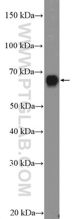 GBP1 Antibody in Western Blot (WB)