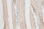 ADAMTSL4 Antibody in Immunohistochemistry (Paraffin) (IHC (P))