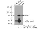 ADAMTSL4 Antibody in Immunoprecipitation (IP)