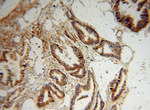 PDXK Antibody in Immunohistochemistry (Paraffin) (IHC (P))