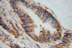PDXK Antibody in Immunohistochemistry (Paraffin) (IHC (P))