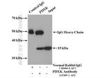 PDXK Antibody in Immunoprecipitation (IP)