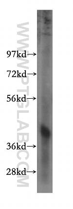 PDXK Antibody in Western Blot (WB)