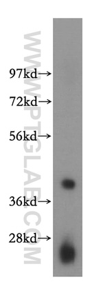 PDXK Antibody in Western Blot (WB)