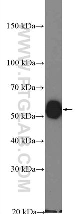 ALDH2 Antibody in Western Blot (WB)