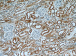 STXBP2 Antibody in Immunohistochemistry (Paraffin) (IHC (P))