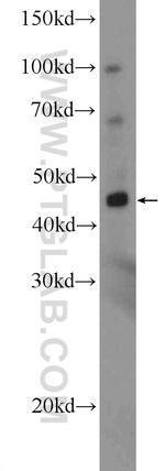 MPPE1 Antibody in Western Blot (WB)