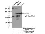 THOC6 Antibody in Immunoprecipitation (IP)