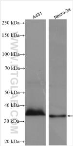 THOC6 Antibody in Western Blot (WB)