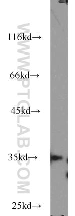 THOC6 Antibody in Western Blot (WB)