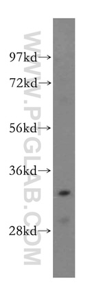 THOC6 Antibody in Western Blot (WB)