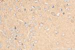 MOAP1 Antibody in Immunohistochemistry (Paraffin) (IHC (P))