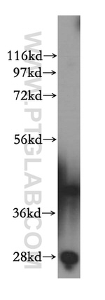 RRS1 Antibody in Western Blot (WB)