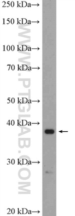 RRS1 Antibody in Western Blot (WB)