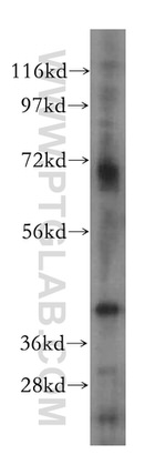 RCL1 Antibody in Western Blot (WB)
