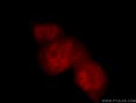 POLR2F Antibody in Immunocytochemistry (ICC/IF)