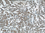 POLR2F Antibody in Immunohistochemistry (Paraffin) (IHC (P))