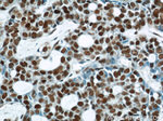 POLR2F Antibody in Immunohistochemistry (Paraffin) (IHC (P))