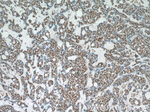 POLR2F Antibody in Immunohistochemistry (Paraffin) (IHC (P))