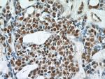POLR2F Antibody in Immunohistochemistry (Paraffin) (IHC (P))