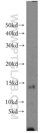 POLR2F Antibody in Western Blot (WB)
