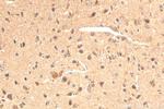 CLPTM1 Antibody in Immunohistochemistry (Paraffin) (IHC (P))